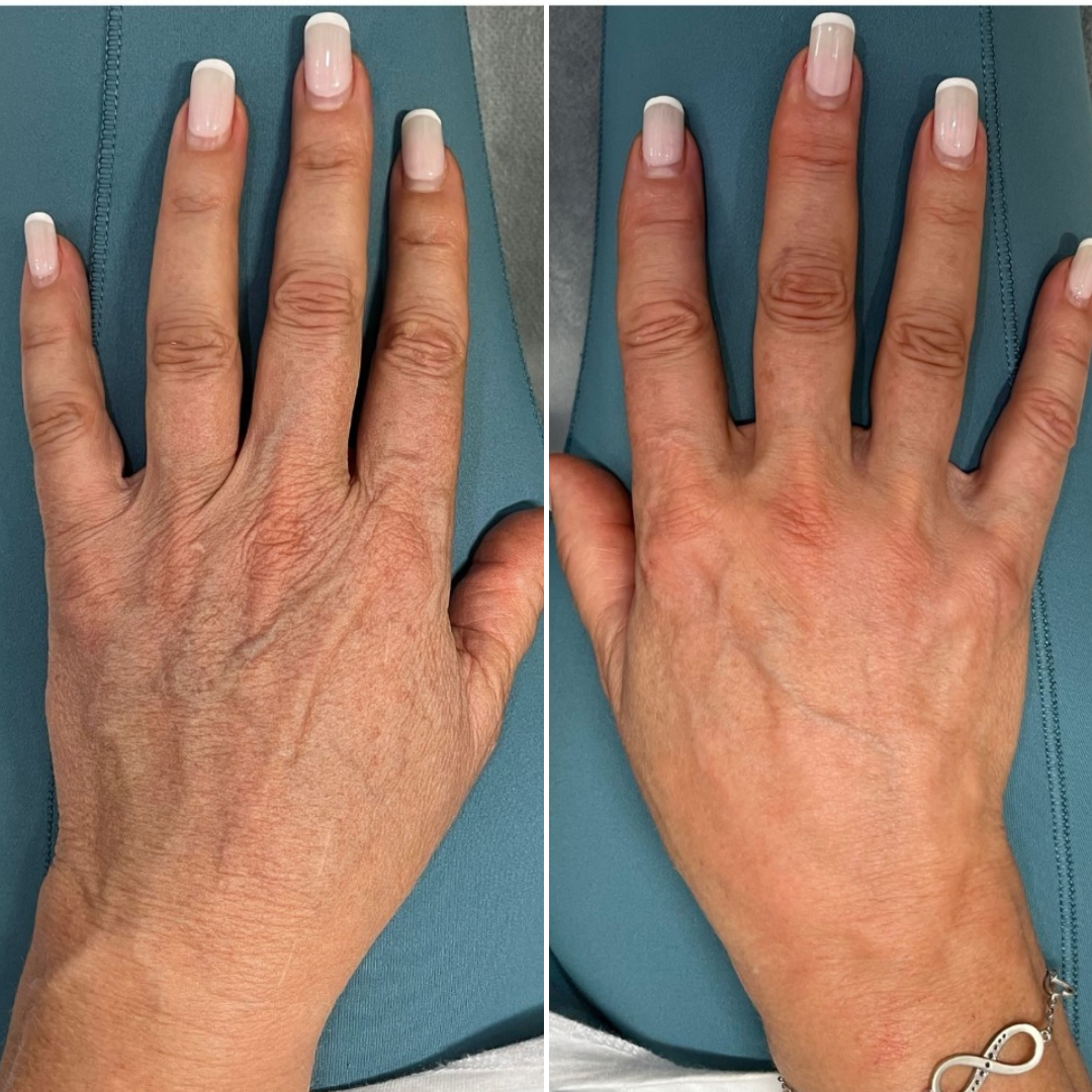 Nuevera HandRenew Anti-Aging El Bakım Kremi
